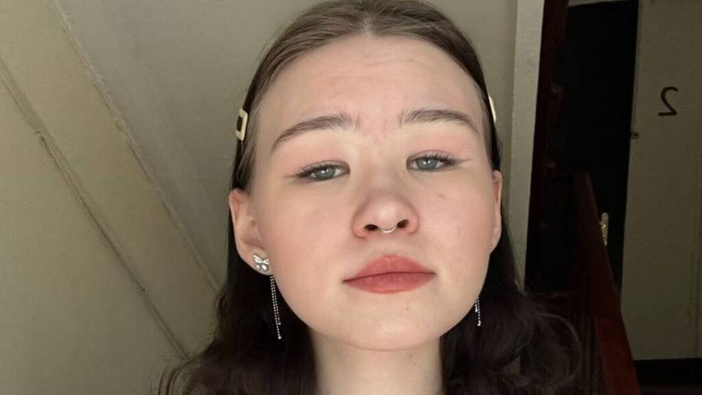 MerlynBurnin